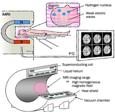 Magnetic resonance imaging (MRI)
