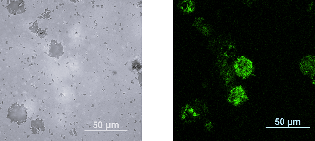粗大気孔を有する窒化ケイ素の金属顕微鏡を用いた反射像と左図と同じ箇所を、レーザーを用いた蛍光顕微鏡で観察した、表面から約3µm下の蛍光像の画像